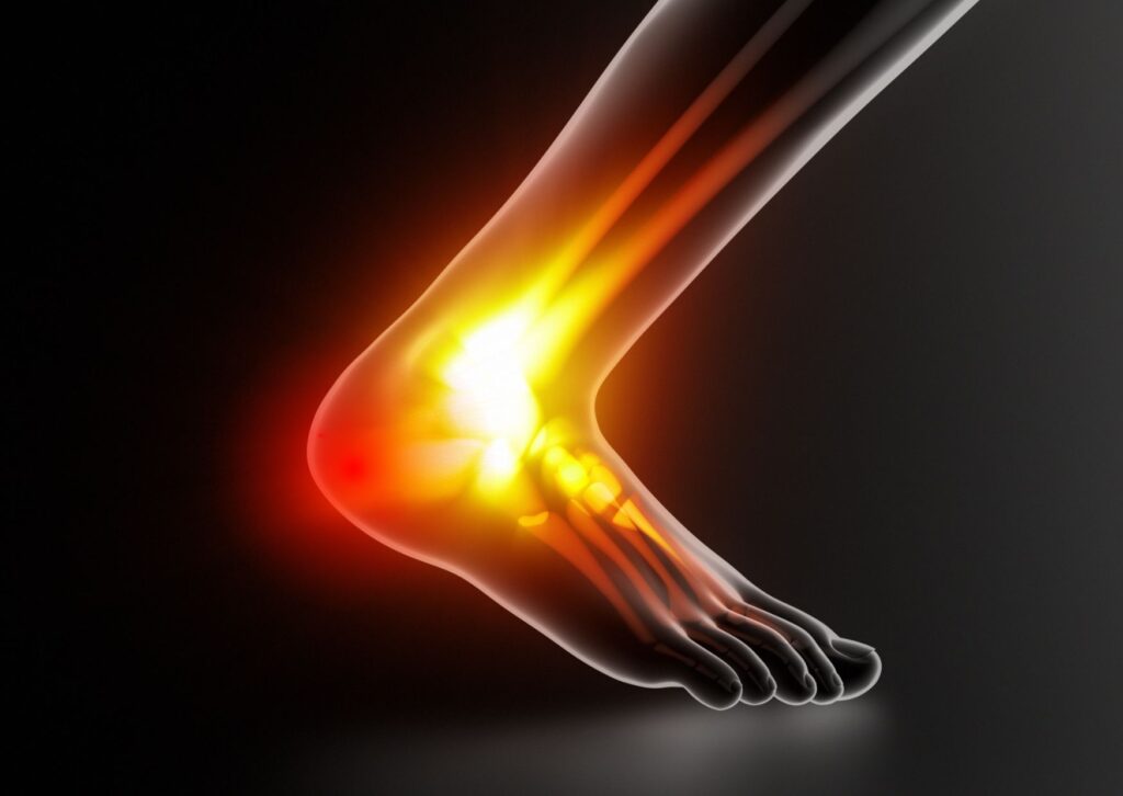 Heel pain